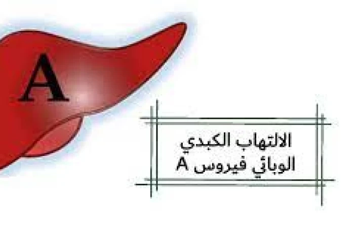 مرض الالتهاب الكبدى A