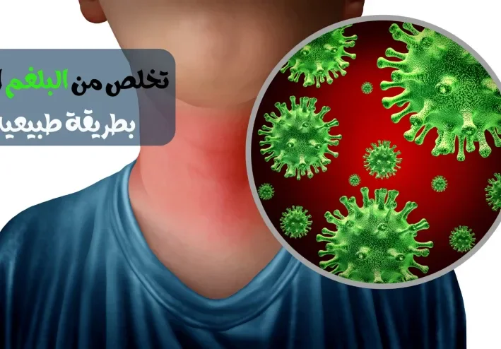 تخلص من البلغم الزائد بطريقة طبيعية و فعالة