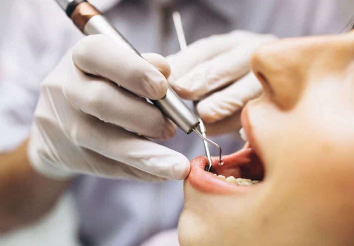 غسيل المخ: كيف يزيد التهاب دواعم السن من خطر الإصابة بمرض الزهايمر