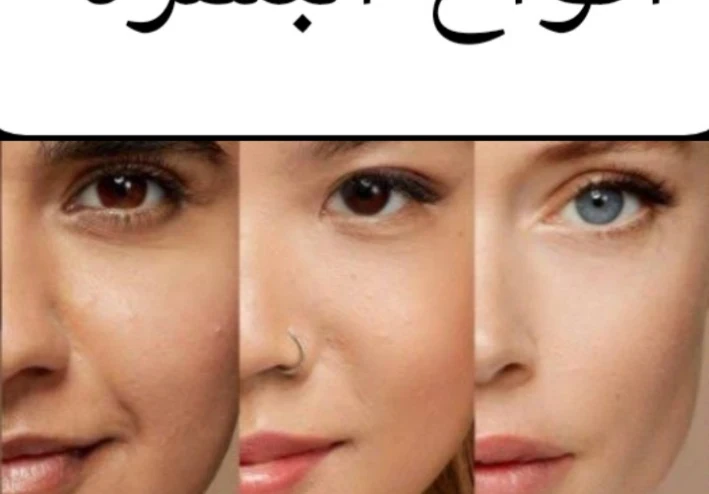 انواع البشره عديده شرح انواع البشره ومميزات انواع كل بشره