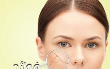 14نوعًا من الأطعمة للمساعدة في حماية البشرة الجافة وترطيبها والعناية بها