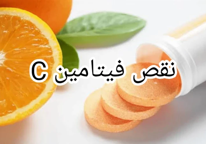 ما هي أعراض نقص فيتامين C ؟