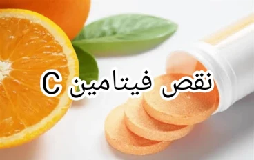 ما هي أعراض نقص فيتامين C ؟