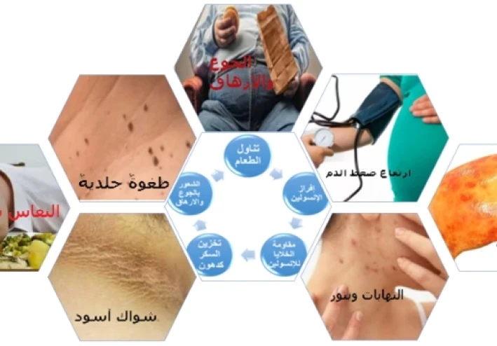 مقاومة الإنسولين هل هي مرض أم سبب المرض؟