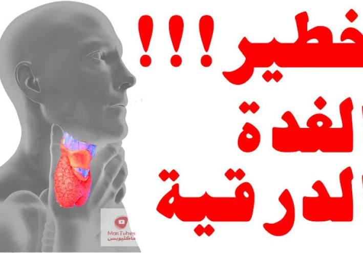 أهم أعراض فرط نشاط الغدة الدرقية