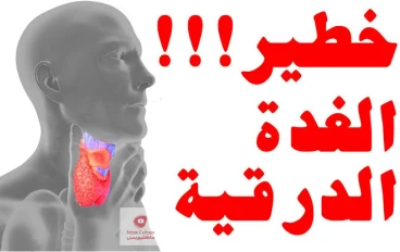أهم أعراض فرط نشاط الغدة الدرقية