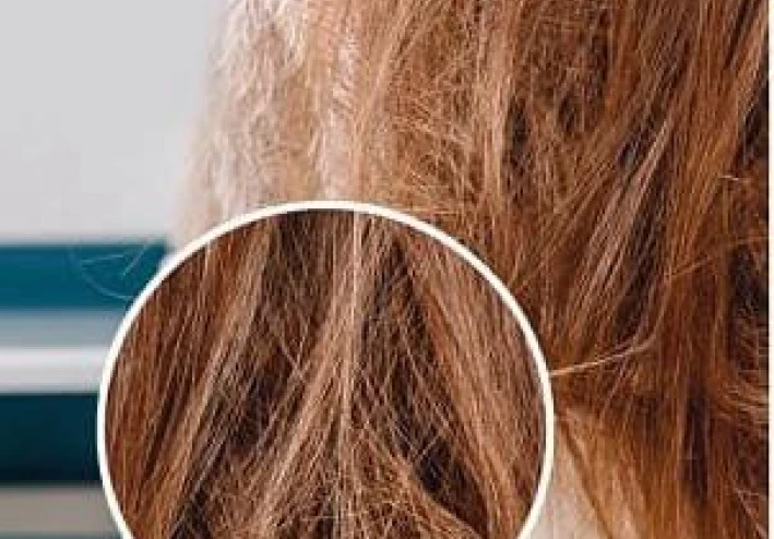 طرق ووصفات طبيعية لعلاج جفاف الشعر .