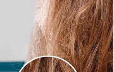 طرق ووصفات طبيعية لعلاج جفاف الشعر . 