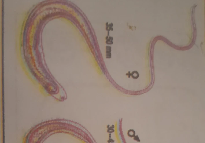 الديدان الطبية_ داء المسلكات_ المسلكة شعرية الرأس  Trichuris Trichiura