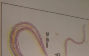 الديدان الطبية_ داء المسلكات_ المسلكة شعرية الرأس  Trichuris Trichiura