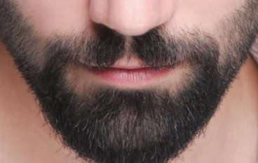 افضل بخاخ لأنبات الشعر مضمون 100%