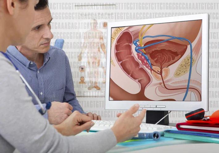 Top Tips for Preventing Prostate Cancer