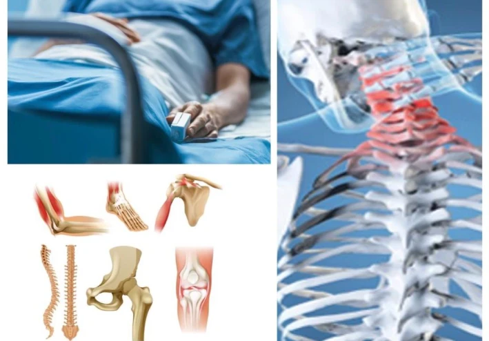 مرض العضال : ما هو ؟ ، و ما هي أعراضه ؟ .