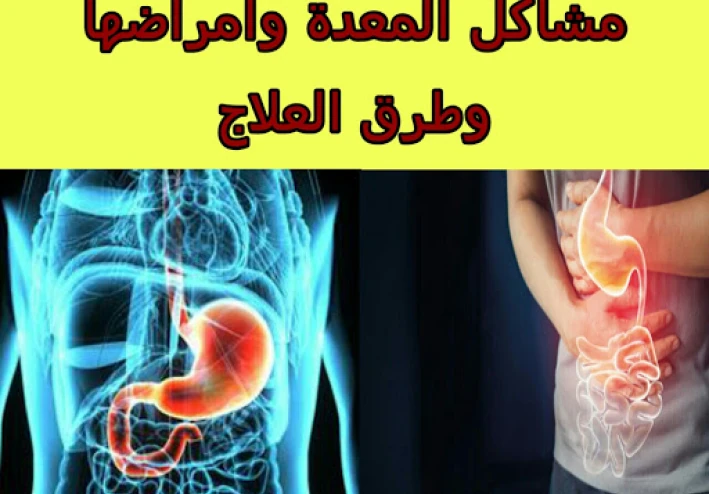 مشاكل المعدة وأمراضها وطرق العلاج