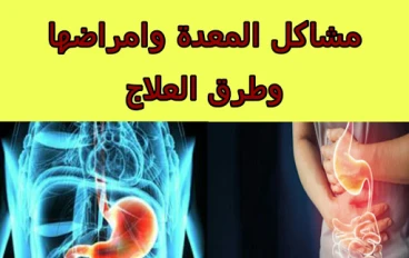 مشاكل المعدة وأمراضها وطرق العلاج