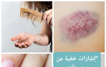 إشارات خفية من جسدك: كيف تكشف عن الأمراض مبكرًا قبل فوات الأوان