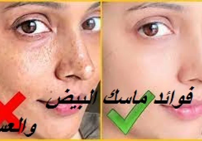 ماسك البيض والعسل  للتخلص من قشور البشرة وجفافها الى الأبد