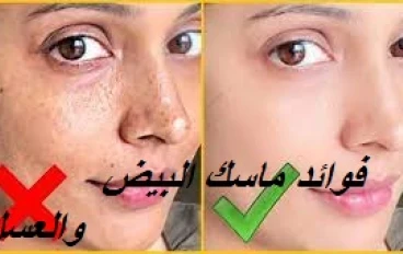 ماسك البيض والعسل  للتخلص من قشور البشرة وجفافها الى الأبد