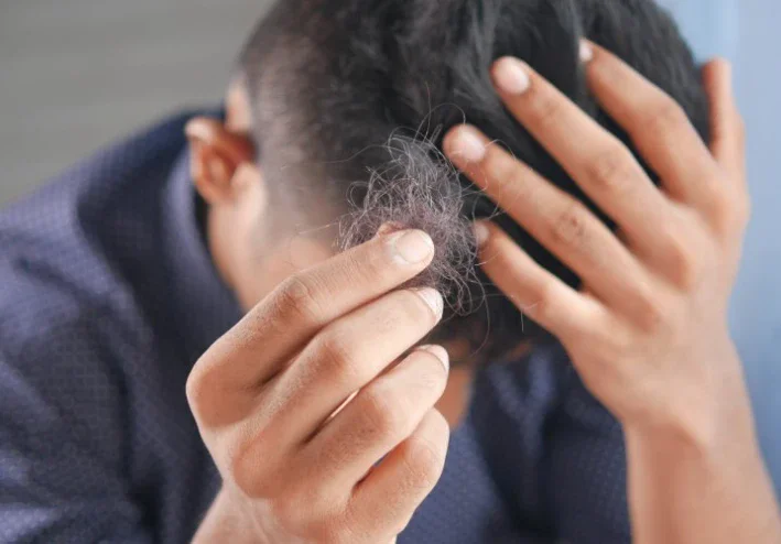 اسباب تساقط الشعر والوقاية وعلاجه