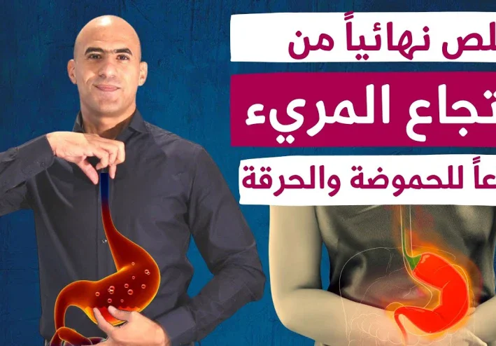 علاج ارتجاع المريء وحرقة المعدة بدون ادوية | الحل الاسرع لحموضة المعدة