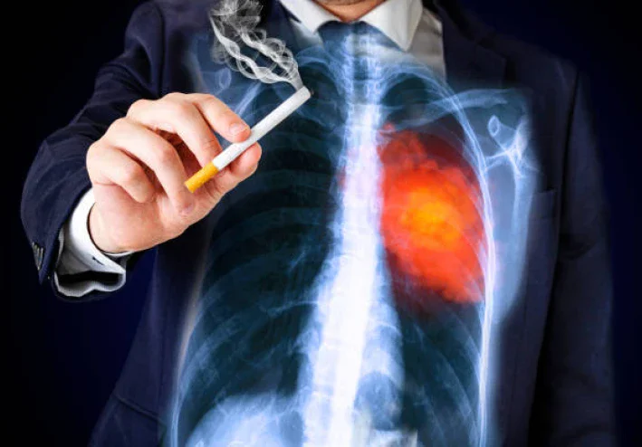 The Hazards of Smoking: Why Immediate Cessation is Crucial