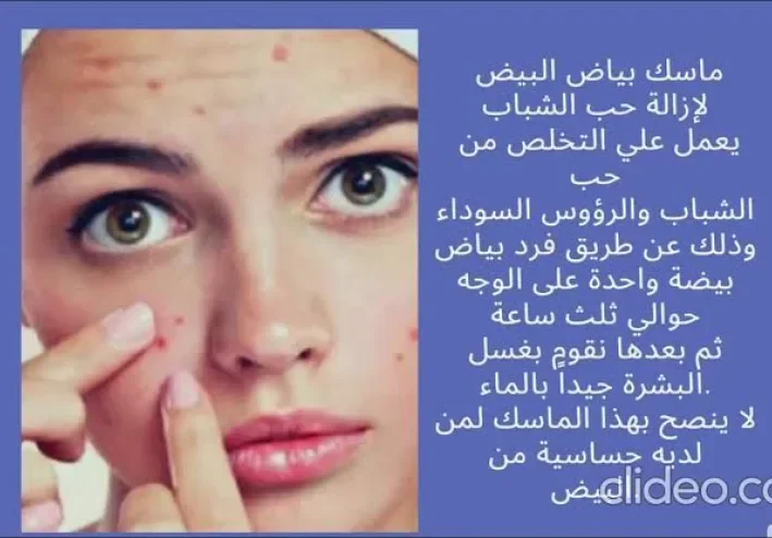 وصفات بسيطة لإزالة أثار الحبوب🧚‍♀️