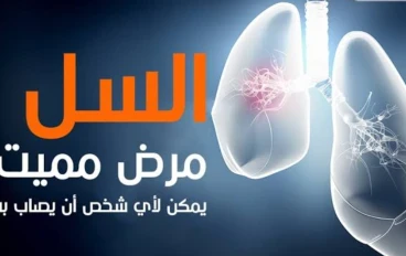 السل وكيف تعالجه