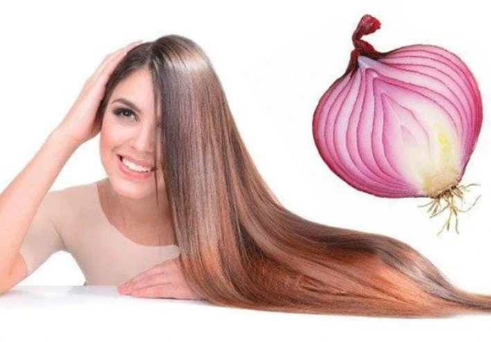 بصله واحدة تكفى لمنع تساقط الشعر