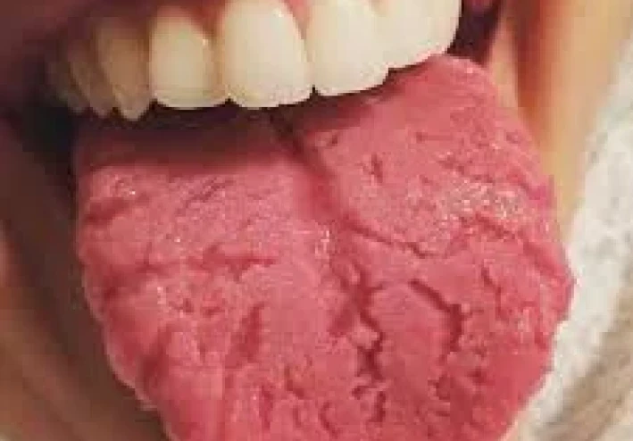 في تشخيص الأمراض