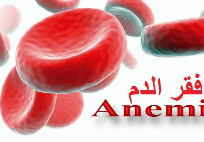 ماهو فقر الدم؟وماهي اسبابه وأعراضه ؟وهل لديه علاج؟
