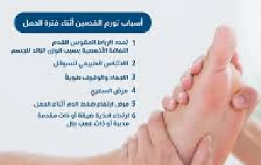 تورم قدميك وأنت لست حاملا .