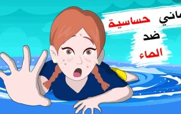 حساسيه الماء ( الشري المائي )
