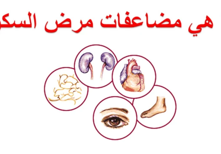 مضاعفات مرض السكري وكيفية الحد منها