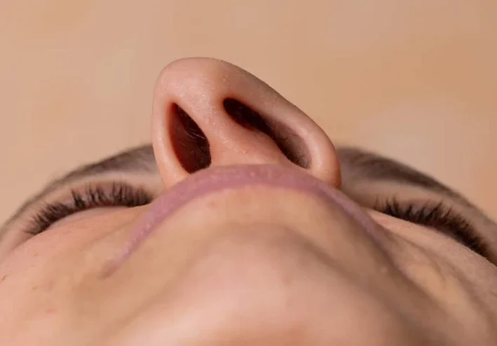 انحراف الحاجز الأنفي
