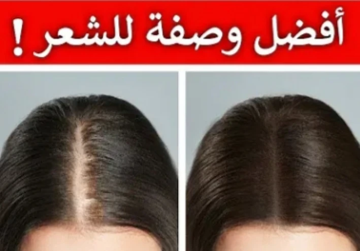 اثنا عشر علاج منزليا بسيطا لتساقط الشعر ولتقوية نمو الشعر ايضا