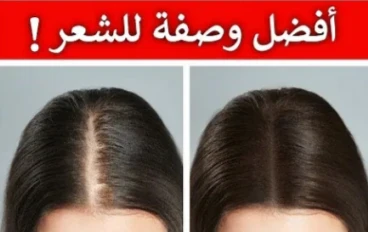 اثنا عشر علاج منزليا بسيطا لتساقط الشعر ولتقوية نمو الشعر ايضا