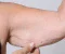 article image for   الترهل في سن اليأس  هذا العلاج هو القنبلة"