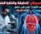 صورة مقال السرطان: المرض الصامت… أسبابه وطرق الوقاية منه