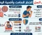 صورة مقال مرض السل: الخطر الصامت وأهمية الوقاية