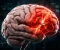 صورة مقال الجلطة الدماغية🧠: القاتل الصامت الذي يسرق الحياة في لحظات
