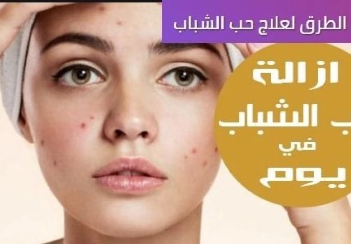 وصفات علاج حب الشباب  و الحصول على بشرة صافية