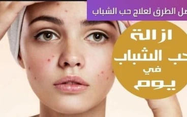 وصفات علاج حب الشباب  و الحصول على بشرة صافية 