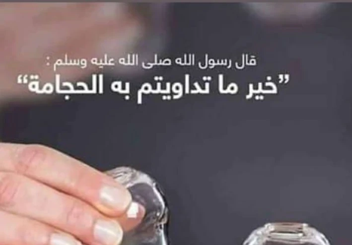 الحجامة.. طب بديل أم علاج طبيعي؟