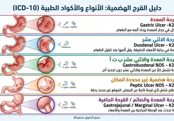 شرح القرح الهضمية الخمس