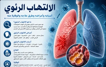 الالتهاب الرئوي: مرض خطير يصيب الجهاز التنفسي