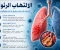 صورة مقال الالتهاب الرئوي: مرض خطير يصيب الجهاز التنفسي