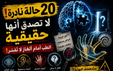 🤯 20 متلازمة نادرة لا يصدقها العقل... لكنها حقيقية وحيّرت العلماء!