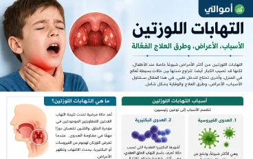 التهابات اللوزتين: الأسباب الخفية، الأعراض المزعجة، وطرق العلاج السريع والوقاية