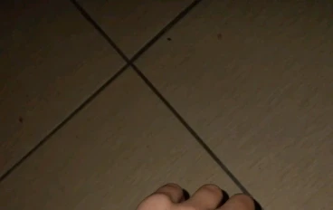 متلازمه اليد الغريبة 
