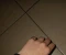 صورة مقال متلازمه اليد الغريبة 